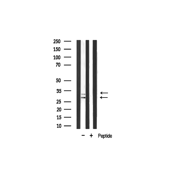 COX11 Antibody - Western blot analysis of COX11 expression in rat muscle lysate