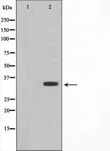 COX11 Antibody - Western blot analysis on RAW264.7 cell lysates using COX11 antibody. The lane on the left is treated with the antigen-specific peptide.