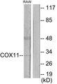 COX11 Antibody - Western blot analysis of extracts from RAW264.7 cells, using COX11 antibody.