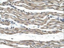 COX15 Antibody - COX15 antibody COX15(COX15 homolog, cytochrome c oxidase assembly protein (yeast)) Antibody was used in IHC to stain formalin-fixed, paraffin-embedded human muscle.  This image was taken for the unconjugated form of this product. Other forms have not been tested.