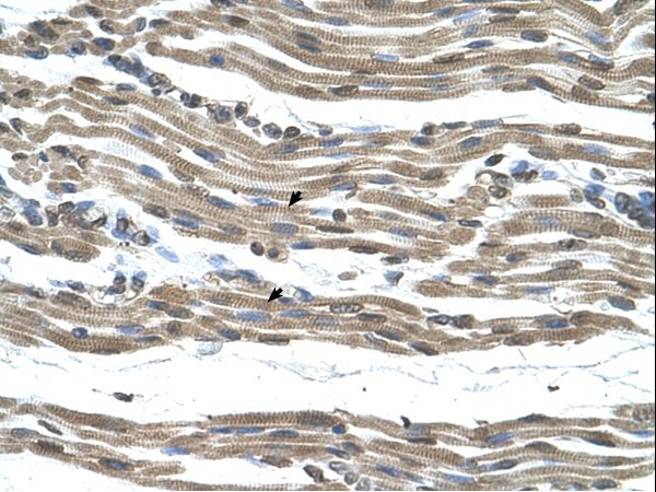 COX15 Antibody - COX15 antibody COX15(COX15 homolog, cytochrome c oxidase assembly protein (yeast)) Antibody was used in IHC to stain formalin-fixed, paraffin-embedded human muscle.  This image was taken for the unconjugated form of this product. Other forms have not been tested.