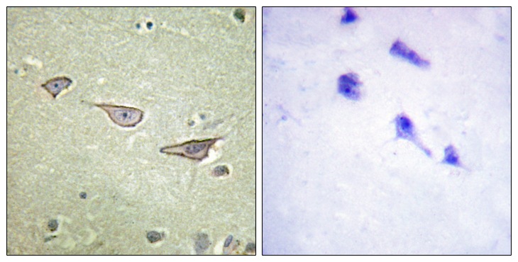 COX15 Antibody - Immunohistochemistry analysis of paraffin-embedded human brain tissue, using COX15 Antibody. The picture on the right is blocked with the synthesized peptide.