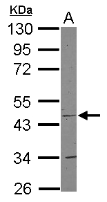COX15 Antibody - Sample (30 ug of whole cell lysate) A: Jurkat 10% SDS PAGE COX15 antibody diluted at 1:1000