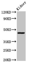 COX15 Antibody - Positive Western Blot detected in Rat kidney tissue. All lanes: COX15 antibody at 3.4 µg/ml Secondary Goat polyclonal to rabbit IgG at 1/50000 dilution. Predicted band size: 47, 44 KDa. Observed band size: 47 KDa