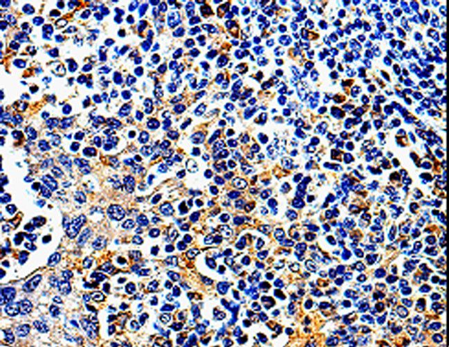 COX16 / C14orf112 Antibody - Immunohistochemistry of paraffin-embedded Human tonsil using COX16 Polyclonal Antibody at dilution of 1:50.