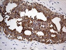 COX17 Antibody - Immunohistochemical staining of paraffin-embedded Human breast tissue within the normal limits using anti-COX17 mouse monoclonal antibody. (Heat-induced epitope retrieval by 1mM EDTA in 10mM Tris buffer. (pH8.5) at 120°C for 3 min. (1:500)