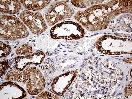 COX17 Antibody - Immunohistochemical staining of paraffin-embedded Human Kidney tissue within the normal limits using anti-COX17 mouse monoclonal antibody. (Heat-induced epitope retrieval by 1mM EDTA in 10mM Tris buffer. (pH8.5) at 120°C for 3 min. (1:500)