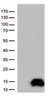 COX17 Antibody - HEK293T cells were transfected with the pCMV6-ENTRY control. (Left lane) or pCMV6-ENTRY COX17. (Right lane) cDNA for 48 hrs and lysed. Equivalent amounts of cell lysates. (5 ug per lane) were separated by SDS-PAGE and immunoblotted with anti-COX17. (1:500)