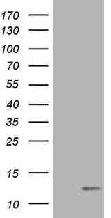 COX17 Antibody - HEK293T cells were transfected with the pCMV6-ENTRY control. (Left lane) or pCMV6-ENTRY COX17. (Right lane) cDNA for 48 hrs and lysed. Equivalent amounts of cell lysates. (5 ug per lane) were separated by SDS-PAGE and immunoblotted with anti-COX17. (1:2000)