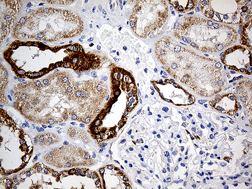 COX17 Antibody - Immunohistochemical staining of paraffin-embedded Human Kidney tissue within the normal limits using anti-COX17 mouse monoclonal antibody. (Heat-induced epitope retrieval by 1mM EDTA in 10mM Tris buffer. (pH8.5) at 120°C for 3 min. (1:500)