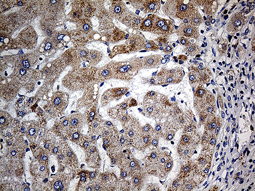 COX17 Antibody - Immunohistochemical staining of paraffin-embedded Human liver tissue within the normal limits using anti-COX17 mouse monoclonal antibody. (Heat-induced epitope retrieval by 1mM EDTA in 10mM Tris buffer. (pH8.5) at 120°C for 3 min. (1:500)