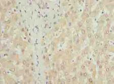 COX17 Antibody - Immunohistochemistry of paraffin-embedded human liver tissue using antibody at dilution of 1:100.