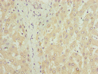 COX17 Antibody - Immunohistochemistry of paraffin-embedded human liver tissue using COX17 Antibody at dilution of 1:100