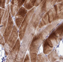 COX17 Antibody - 1:100 staining human skeletal muscle tissue by IHC-P. The tissue was formaldehyde fixed and a heat mediated antigen retrieval step in citrate buffer was performed. The tissue was then blocked and incubated with the antibody for 1.5 hours at 22°C. An HRP conjugated goat anti-rabbit antibody was used as the secondary.
