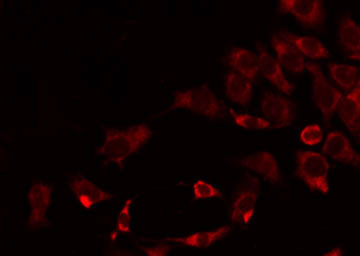 COX17 Antibody - Staining HeLa cells by IF/ICC. The samples were fixed with PFA and permeabilized in 0.1% Triton X-100, then blocked in 10% serum for 45 min at 25°C. The primary antibody was diluted at 1:200 and incubated with the sample for 1 hour at 37°C. An Alexa Fluor 594 conjugated goat anti-rabbit IgG (H+L) Ab, diluted at 1/600, was used as the secondary antibody.