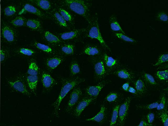 COX17 Antibody - Immunofluorescence staining of COX17 in U2OS cells. Cells were fixed with 4% PFA, permeabilzed with 0.1% Triton X-100 in PBS, blocked with 10% serum, and incubated with rabbit anti-Human COX17 polyclonal antibody (dilution ratio 1:100) at 4°C overnight. Then cells were stained with the Alexa Fluor 488-conjugated Goat Anti-rabbit IgG secondary antibody (green) and counterstained with DAPI (blue). Positive staining was localized to Cytoplasm.