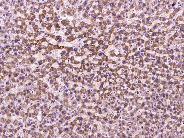 COX17 Antibody - Immunochemical staining of human COX17 in human liver with rabbit polyclonal antibody at 1:100 dilution, formalin-fixed paraffin embedded sections.