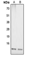 COX17 Antibody - Western blot analysis of COX17 expression in IMR32 (A); HepG2 (B) whole cell lysates.