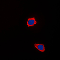 COX17 Antibody - Immunofluorescent analysis of COX17 staining in HepG2 cells. Formalin-fixed cells were permeabilized with 0.1% Triton X-100 in TBS for 5-10 minutes and blocked with 3% BSA-PBS for 30 minutes at room temperature. Cells were probed with the primary antibody in 3% BSA-PBS and incubated overnight at 4 C in a humidified chamber. Cells were washed with PBST and incubated with a DyLight 594-conjugated secondary antibody (red) in PBS at room temperature in the dark. DAPI was used to stain the cell nuclei (blue).