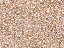COX17 Antibody - Immunochemical staining of human COX17 in human liver with rabbit polyclonal antibody at 1:1000 dilution, formalin-fixed paraffin embedded sections.