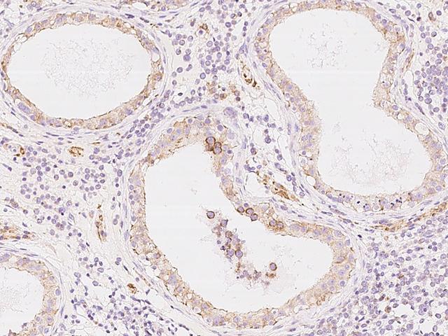 COX17 Antibody - Immunochemical staining of human COX17 in human testis with rabbit polyclonal antibody at 1:1000 dilution, formalin-fixed paraffin embedded sections.