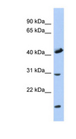 COX18 Antibody - COX18 antibody Western blot of Fetal Muscle lysate. This image was taken for the unconjugated form of this product. Other forms have not been tested.