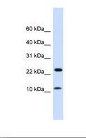 COX20 Antibody - Fetal muscle lysate. Antibody concentration: 1.0 ug/ml. Gel concentration: 10-20%.  This image was taken for the unconjugated form of this product. Other forms have not been tested.