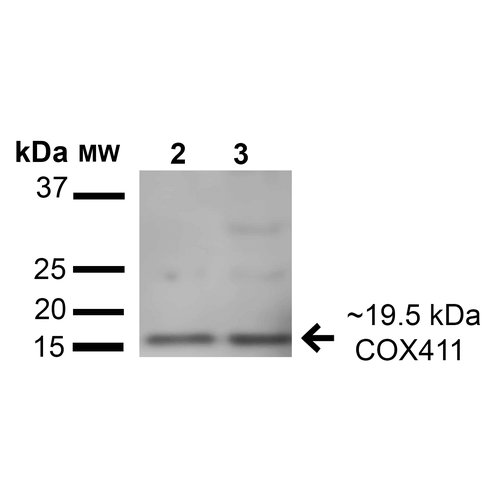 COX4 Antibody - Western blot analysis of Human HeLa and HEK293T cell lysates showing detection of 19.5 kDa COX-4 protein using Rabbit Anti-COX-4 Polyclonal Antibody. Lane 1: Molecular Weight Ladder (MW). Lane 2: HeLa cell lysates. Lane 3: 293Trap cell lysates. Load: 15 µg. Block: 5% Skim Milk in 1X TBST. Primary Antibody: Rabbit Anti-COX-4 Polyclonal Antibody  at 1:1000 for 1 hour at RT. Secondary Antibody: Goat Anti-Rabbit HRP at 1:2000 for 60 min at RT. Color Development: ECL solution for 6 min in RT. Predicted/Observed Size: 19.5 kDa.