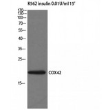 COX4I2 Antibody - Western blot of COX4I2 antibody