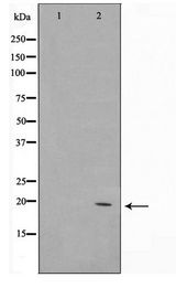 COX4I2 Antibody - Western blot of K562 cell lysate using COX42 Antibody