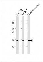 COX4I2 Antibody - All lanes: Anti-COXIV Isoform 2 Antibody at 1:2000 dilution Lane 1: HepG2 whole cell lysate Lane 2: MCF-7 whole cell lysate Lane 3: mouse small intestine lysate Lysates/proteins at 20 µg per lane. Secondary Goat Anti-Rabbit IgG, (H+L), Peroxidase conjugated at 1/10000 dilution. Predicted band size: 20 kDa Blocking/Dilution buffer: 5% NFDM/TBST.