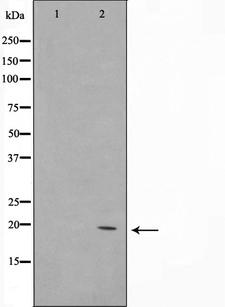 COX4I2 Antibody - Western blot analysis on K562 cell lysates using COX42 antibody. The lane on the left is treated with the antigen-specific peptide.