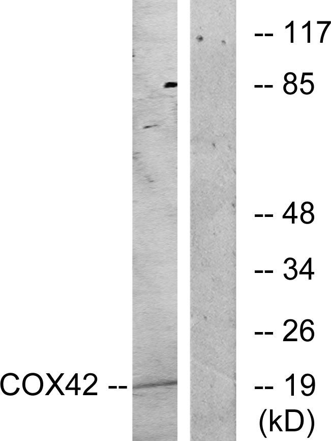 COX4I2 Antibody - Western blot analysis of extracts from K562 cells, treated with insulin (0.01U/ml, 15mins), using COX42 antibody.