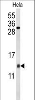 COX5A Antibody - Western blot of COX5A Antibody in HeLa cell line lysates (35 ug/lane). COX5A (arrow) was detected using the purified antibody.