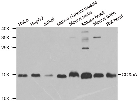COX5A Antibody - Western blot analysis of extracts of various cell lines.