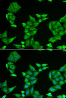 COX5A Antibody - Immunofluorescence analysis of HeLa cells.