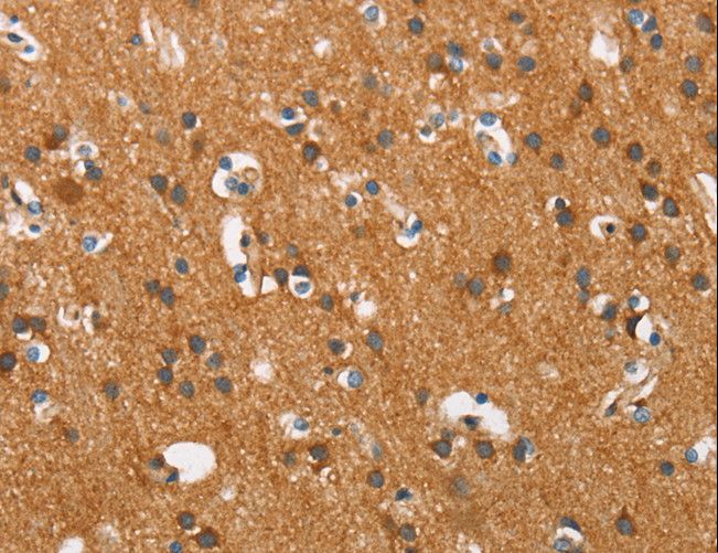 COX5A Antibody - Immunohistochemistry of paraffin-embedded Human brain using COX5A Polyclonal Antibody at dilution of 1:40.