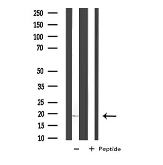 COX5A Antibody - Western blot analysis of extracts of A549 cells using COX5A antibody.