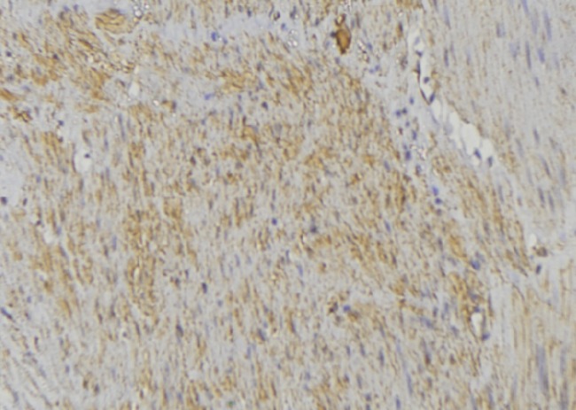 COX5A Antibody - 1:100 staining mouse muscle tissue by IHC-P. The sample was formaldehyde fixed and a heat mediated antigen retrieval step in citrate buffer was performed. The sample was then blocked and incubated with the antibody for 1.5 hours at 22°C. An HRP conjugated goat anti-rabbit antibody was used as the secondary.