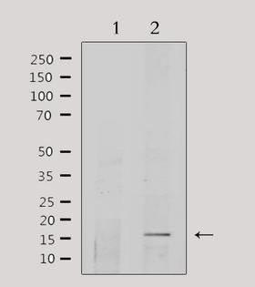 COX5A Antibody - Western blot analysis of extracts of HepG2 cells using COX5A antibody. Lane 1 was treated with the antigen-specific peptide.