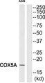 COX5A Antibody - Western blot analysis of extracts from A549 cells, using COX5A antibody.