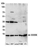 COX5B Antibody - Detection of human and mouse COX5B by western blot. Samples: Whole cell lysate (15 µg) from HeLa, HEK293T, Jurkat, mouse TCMK-1, and mouse NIH 3T3 cells prepared using NETN lysis buffer. Antibody: Affinity purified rabbit anti-COX5B antibody used for WB at 0.1 µg/ml. Detection: Chemiluminescence with an exposure time of 3 minutes.