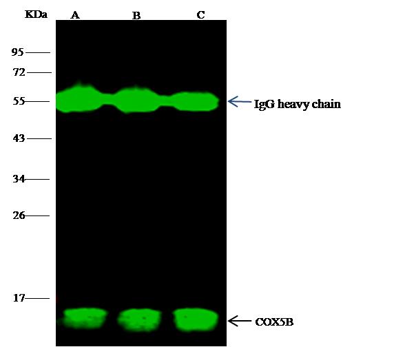 COX5B Antibody - COX5B was immunoprecipitated using: Lane A: 0.5 mg A549 Whole Cell Lysate. Lane B: 0.5 mg Hela Whole Cell Lysate. Lane C:0.5 mg HepG2 Whole Cell Lysate. 2 uL anti-COX5B rabbit monoclonal antibody and 15 ul of 50% Protein G agarose. Primary antibody: Anti-COX5B rabbit monoclonal antibody, at 1:100 dilution. Secondary antibody: Dylight 800-labeled antibody to rabbit IgG (H+L), at 1:5000 dilution. Developed using the odssey technique. Performed under reducing conditions. Predicted band size: 14 kDa. Observed band size: 14 kDa.