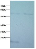 COX5B Antibody - Western blot of Cytochrome c oxidase subunit 5B, mitochondrial antibody at 2 ug/ml. Lane 1: EC109 whole cell lysate. Lane 2: 293T whole cell lysate. Secondary: Goat polyclonal to Rabbit IgG at 1:15000 dilution. Predicted band size: 14 kDa. Observed band size: 14 kDa Additional bands at: 65 kDa. We are unsure as to the identity of this extra band.  This image was taken for the unconjugated form of this product. Other forms have not been tested.