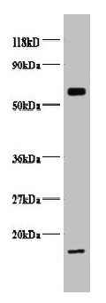 COX5B Antibody - Western blot All lanes: COX5B antibody at 2µg/ml + EC109 whole cell lysate Secondary Goat polyclonal to Rabbit IgG at 1/15000 dilution Predicted band size: 14 kDa Observed band size: 14, 65 kDa
