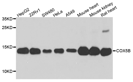 COX5B Antibody - Western blot analysis of extract of various cells.