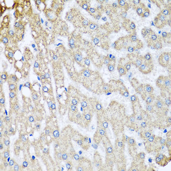 COX5B Antibody - Immunohistochemistry of paraffin-embedded human liver injury tissue.