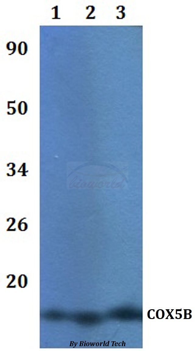 COX5B Antibody - Western blot of COX5B antibody at 1:500 dilution. Lane 1: HEK293T whole cell lysate. Lane 2: RAW264.7 whole cell lysate.