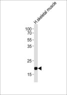 COX6A2 Antibody - Western blot of lysate from human skeletal muscle tissue lysate, using COX6A2 Antibody. Antibody was diluted at 1:1000. A goat anti-rabbit IgG H&L (HRP) at 1:10000 dilution was used as the secondary antibody. Lysate at 20ug.