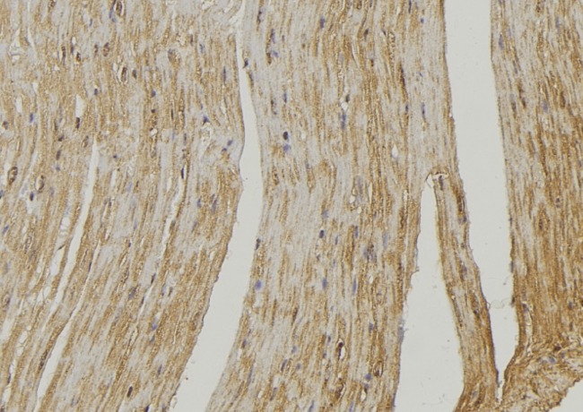 COX6A2 Antibody - 1:100 staining mouse muscle tissue by IHC-P. The sample was formaldehyde fixed and a heat mediated antigen retrieval step in citrate buffer was performed. The sample was then blocked and incubated with the antibody for 1.5 hours at 22°C. An HRP conjugated goat anti-rabbit antibody was used as the secondary.